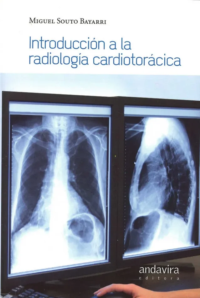 Introducción a la radiología torácica